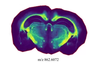 A spatial distribution map of one metabolite